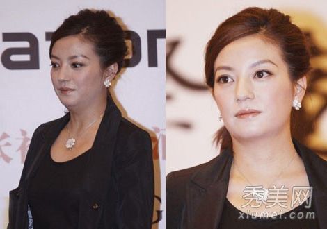 盤點產(chǎn)后發(fā)福女星王艷雙下巴明顯