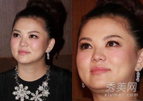 盤點產(chǎn)后發(fā)福女星王艷雙下巴明顯